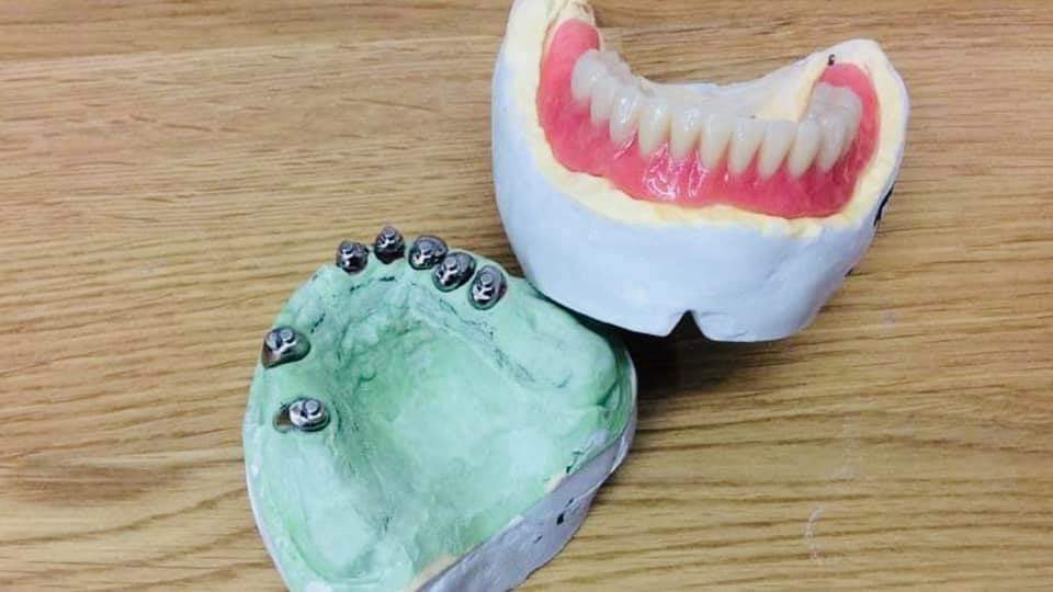 Orthodontic treatment